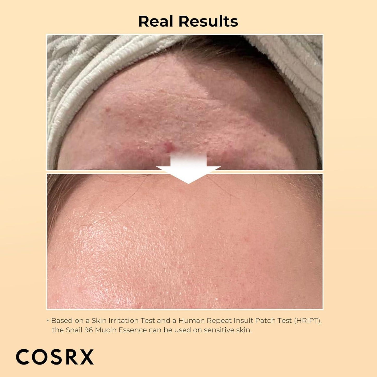 Advanced Snail 96 Mucin Power Essence - 100ml - By Cosrx