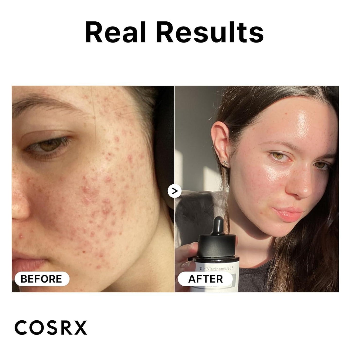 The Niacinamide 15 Serum 20ml - By Cosrx